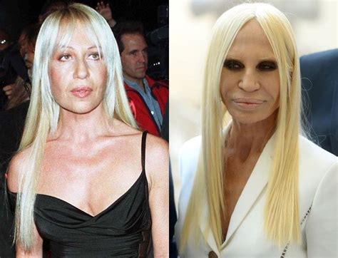 donatella versace foto come oggi|donatella versace before and after.